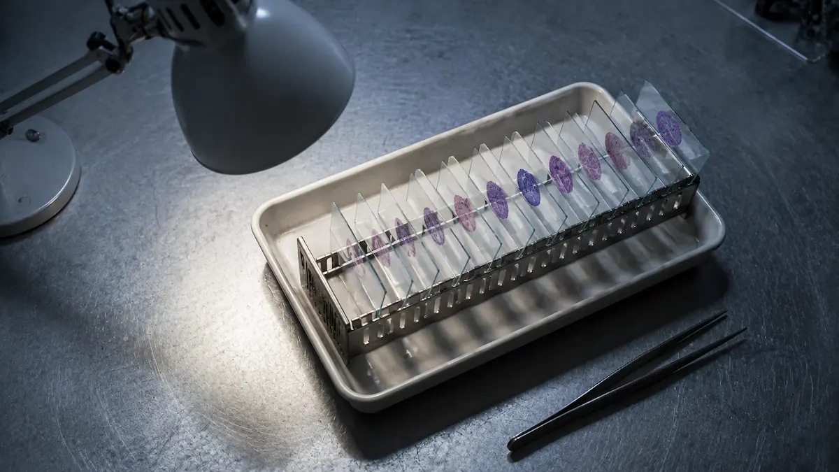 Endoscop flexibil atârnat într-un dulap de uscare, de tipul folosit pentru subsetul endoscopic din această cohortă.